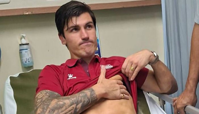 Update Kondisi Tulang Rusuk Sergio Castel, Bukan Cedera Berat